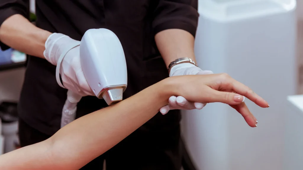 تكلفة ازالة الشعر بالليزر