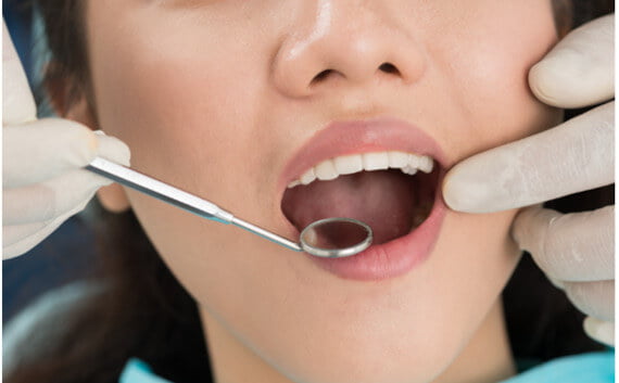 علاج فطريات الفم