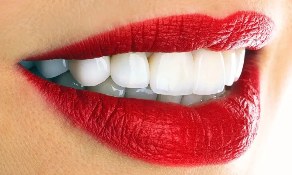 ابتسامة هوليود