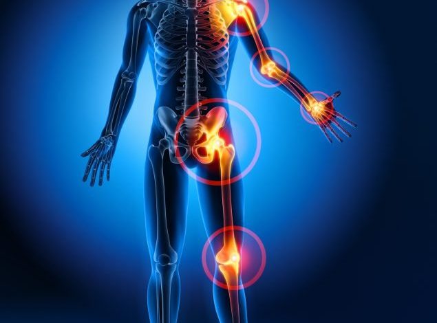 مرض الروماتيزم